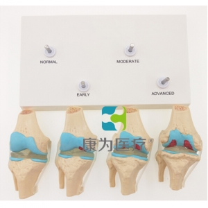 “康为医疗”4阶段膝关节模型