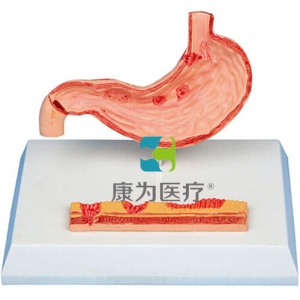 上海“康为医疗”病态胃模型