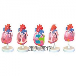 “康为医疗”先天性心脏畸形模型（5部件）