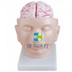 太仓“康为医疗”头部附脑动脉模型