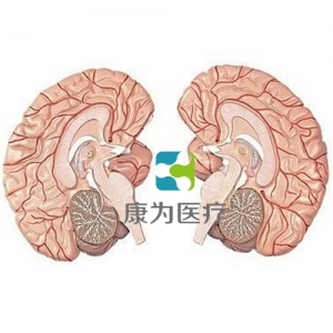 张家港“康为医疗”左右脑带脑动脉分布模型　2部件