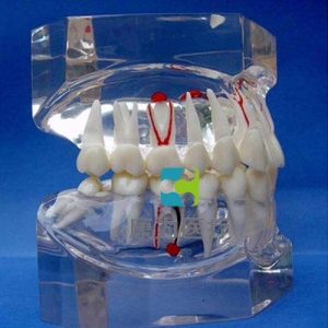 “康为医疗”透明牙体病理模型