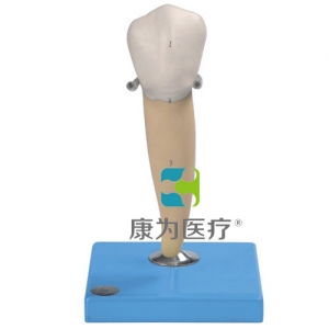 张家港“康为医疗”前磨牙有一个牙根模型